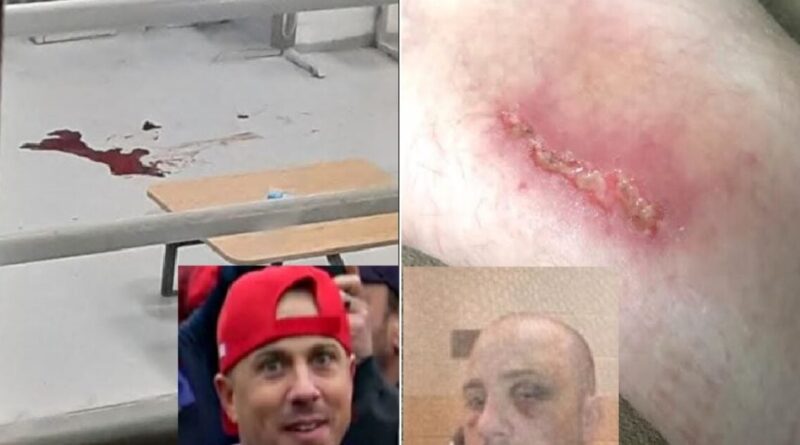 EXCLUSIVE: Photos Obtained Following J6 Political Prisoner Ryan Samsel's Brutal Beating by Guards and Following Police Abuse with Shackles - AUDIO | The Gateway Pundit | by Jim Hoft